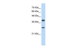 CIAO1 Rabbit anti-Human, Polyclonal, Novus Biologicals 0.1 mL | Buy Online | Novus Biologicals | Fisher Scientific